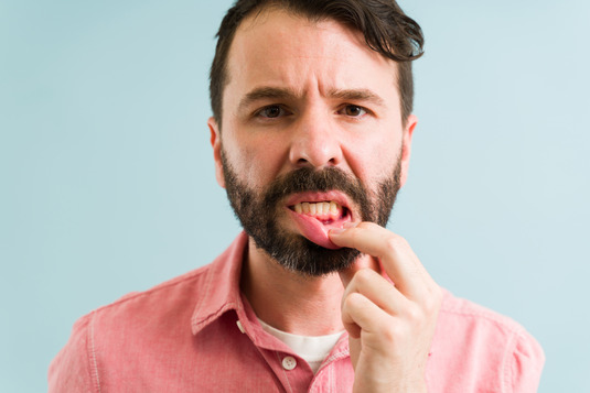 man pointing to denture sores